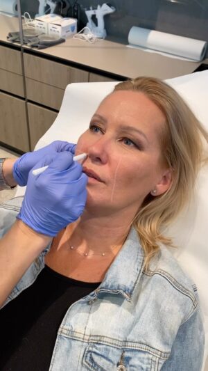 Erika Barkolová Instagram - Ahojte! Mam pre vas fantasticku vianocnu sutaz!!!!! POZOR!!! 💥💥💥💥💥Mozes ziskat poukazku v hodnote neuveritelnych 250 EUR na skraslenie v @skinklinik.sk v Bratislave pod vedenim uzasnej pani doktorky @martina.hlavata Staci, ak das #follow @skinklinik.sk a mne a do komentu napises meno, komu by si poukazku venovala a pripadne, co by si si dala vylepsit, zhydratovat, zdokonalit…muzi, fakt paradny vianocny darcek pre vase polovicky. Viac info o procedurach v @skinklinik.sk najdes u mna v BIO #sutaz #vianoce #poukazka #skinklinik Vitaza alebo vitazku vyzrebujem v piatok 22.12 ☃️