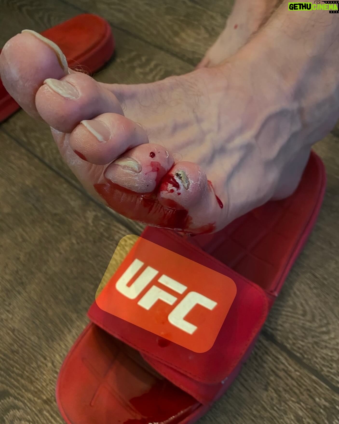 Forrest Griffin - 2.4K Likes - You should see the look on the pedicure lady’s face. #blood #ufc #feet #bloody #toes