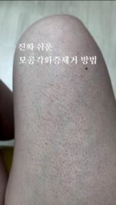 Heo An-na Top 100 Instagram Photos and Posts