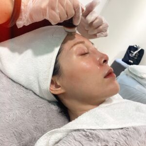 Hsuan-yen Tsai Instagram - 做完黑鑽水飛梭之後當天的素臉。

這台機器擁有360度旋轉的矽膠探頭，矽膠探頭非常親膚，除了帶走老舊角質和髒污，還同時注入精華液來清潔毛孔、滋潤提亮膚質。非常適合容易紅腫過敏的膚質。
你看看這光芒，有夠亮捏！

#黑鑽水飛梭 #dermaclear #保養 #清潔