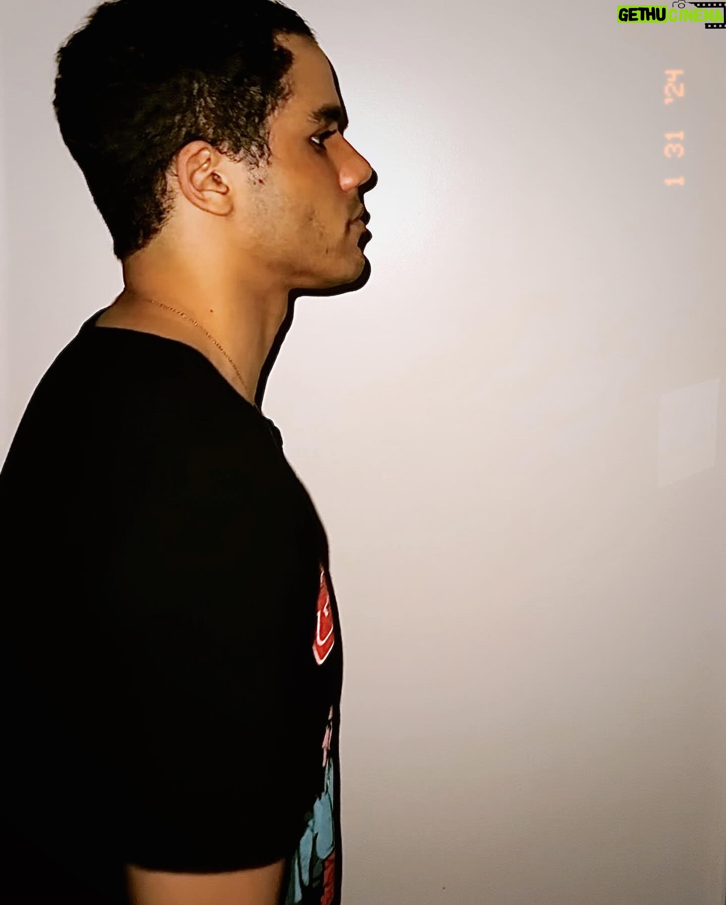 Jacob Artist - 3 Likes - before🩸5 days