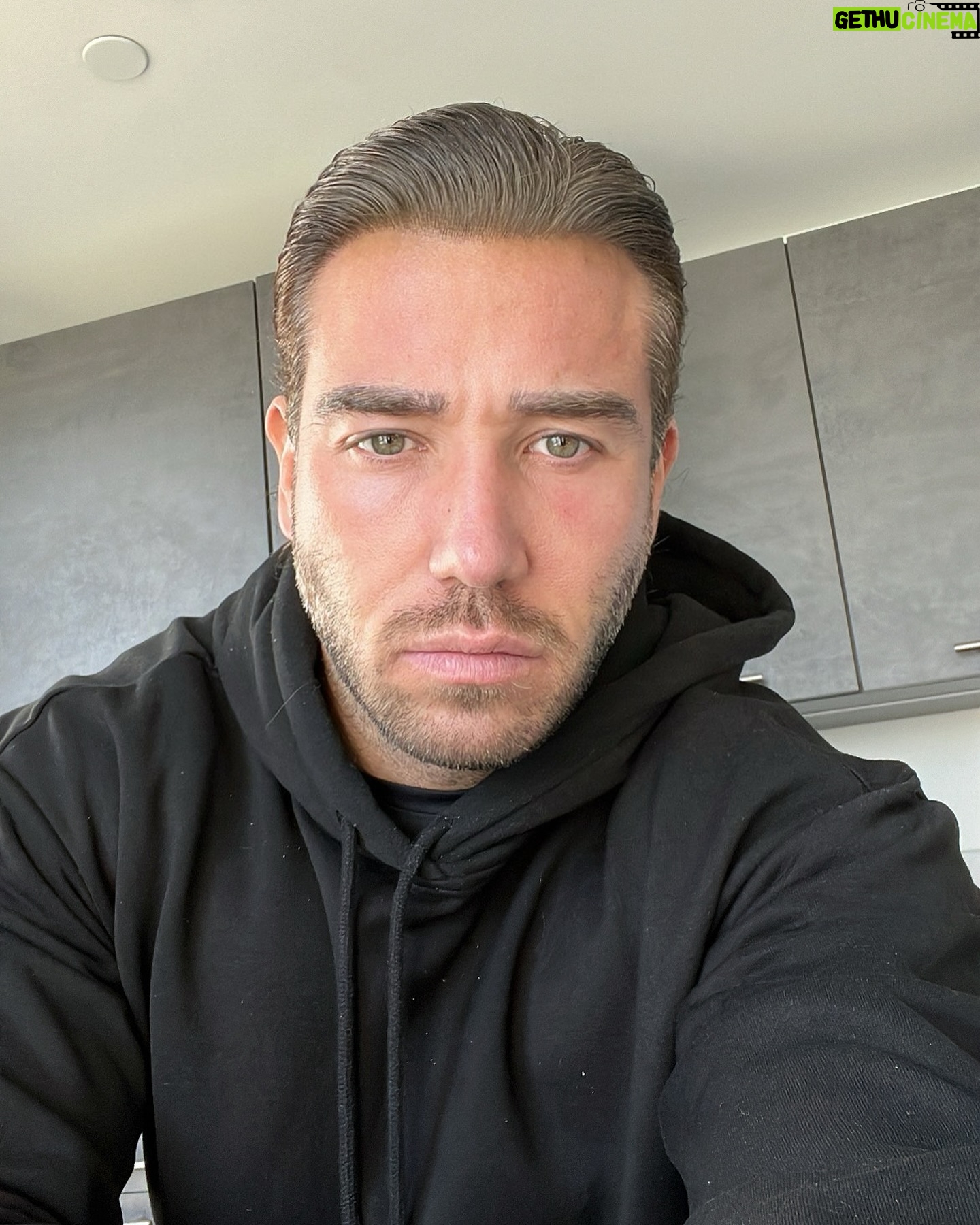 James Lock - 21.1K Likes - Slick Rick! 😎 the eyes and nose are almost completely healed now thanks to @serenecosmetic_ & @comfortzonesurgeryofficial been just over 7 weeks thank you for helping me with my reconstructive surgery after my accident ❤️
-
For all enquiries contact @serenecosmetic_ 👌🏽