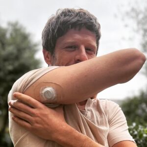 James Norton Instagram - World Diabetes Day was last tuesday (I’m a little late to the party). This year @dexcomuk asked what we’d like the world to know about living with type 1 diabetes. One misconception I often come across is “that means you can’t eat sugar, right?”. The truth is we diabetics can enjoy a sugary pudding if we want one, we just have to make sure we administer the correct amount of insulin.  The more sugary the desert, the more insulin required. And sometimes, when we’ve had too much insulin and are low on sugar (or hypoglycaemic) we need to eat to sugar as a matter of urgency.  It’s all a very important and slightly tedious balancing act. And technology like Dexcom make that balancing a hell if a lot easier. 

So hand over the brownie! 👊

#seediabetes @dexcom #ad #dexcomuk #dexcomwarrior