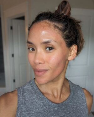 Jessalyn Wanlim Instagram - No filters and going on 41! Thank you @toyosclinicaesthetics for round 2 of #mixtolaser resurfacing treatment. I've gotten so many compliments on my skin and now we're just working on some stubborn acne scars 🤍
1. 15 minutes after treatment (and barely any redness at that!)
2. Waiting for numbing cream to do its work
3. Immediately after my mixto session
4. Dr. Melissa did my hands too since I have massive insecurities there🙈
.
.
.
.
#antiaging #laserresurfacing #nashville #medspa #laserresurfacingtreatment #mixto