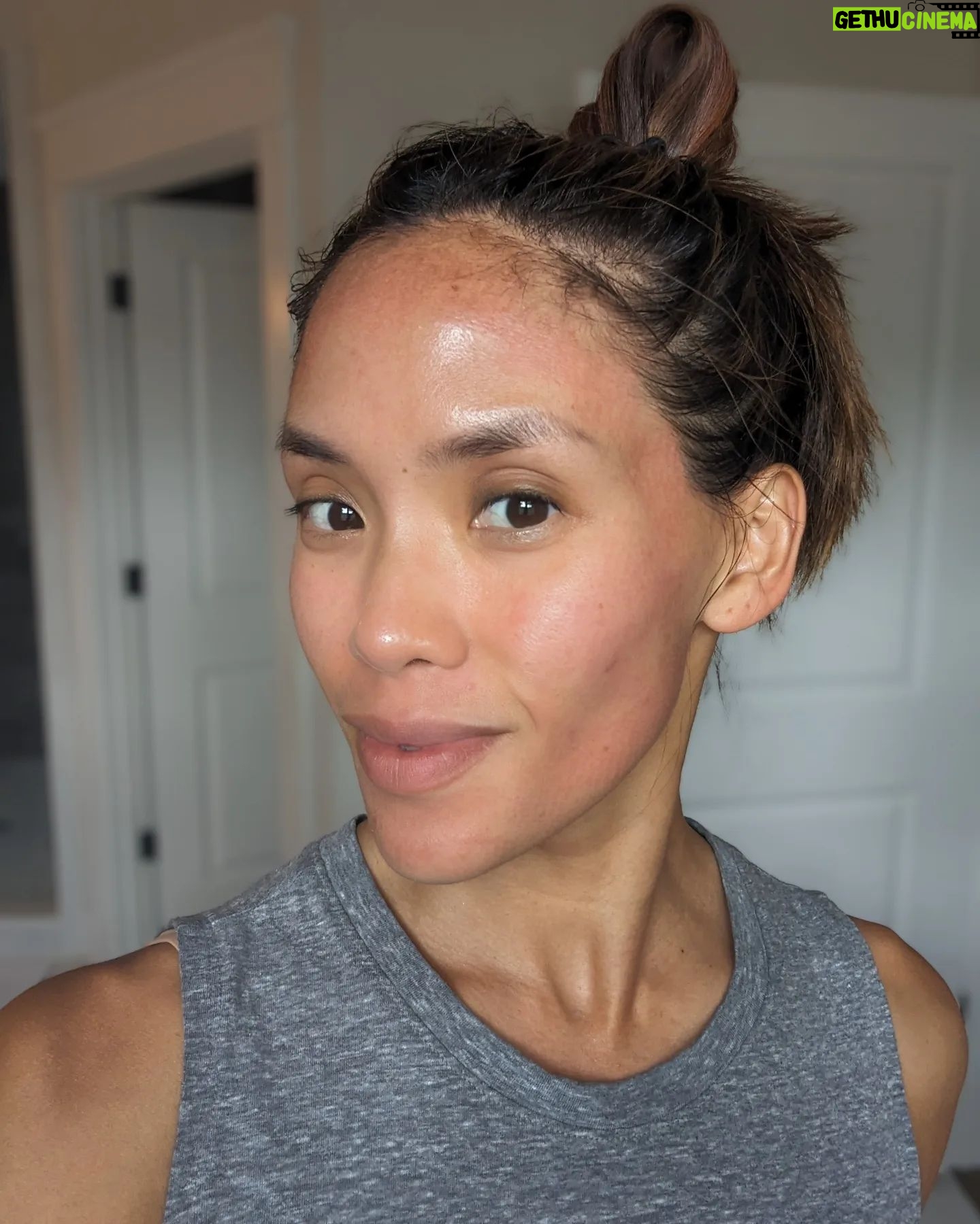 Jessalyn Wanlim - 3 Likes - No filters and going on 41! Thank you @toyosclinicaesthetics for round 2 of #mixtolaser resurfacing treatment. I've gotten so many compliments on my skin and now we're just working on some stubborn acne scars š¤
1. 15 minutes after treatment (and barely any redness at that!)
2. Waiting for numbing cream to do its work
3. Immediately after my mixto session
4. Dr. Melissa did my hands too since I have massive insecurities thereš
.
.
.
.
#antiaging #laserresurfacing #nashville #medspa #laserresurfacingtreatment #mixto