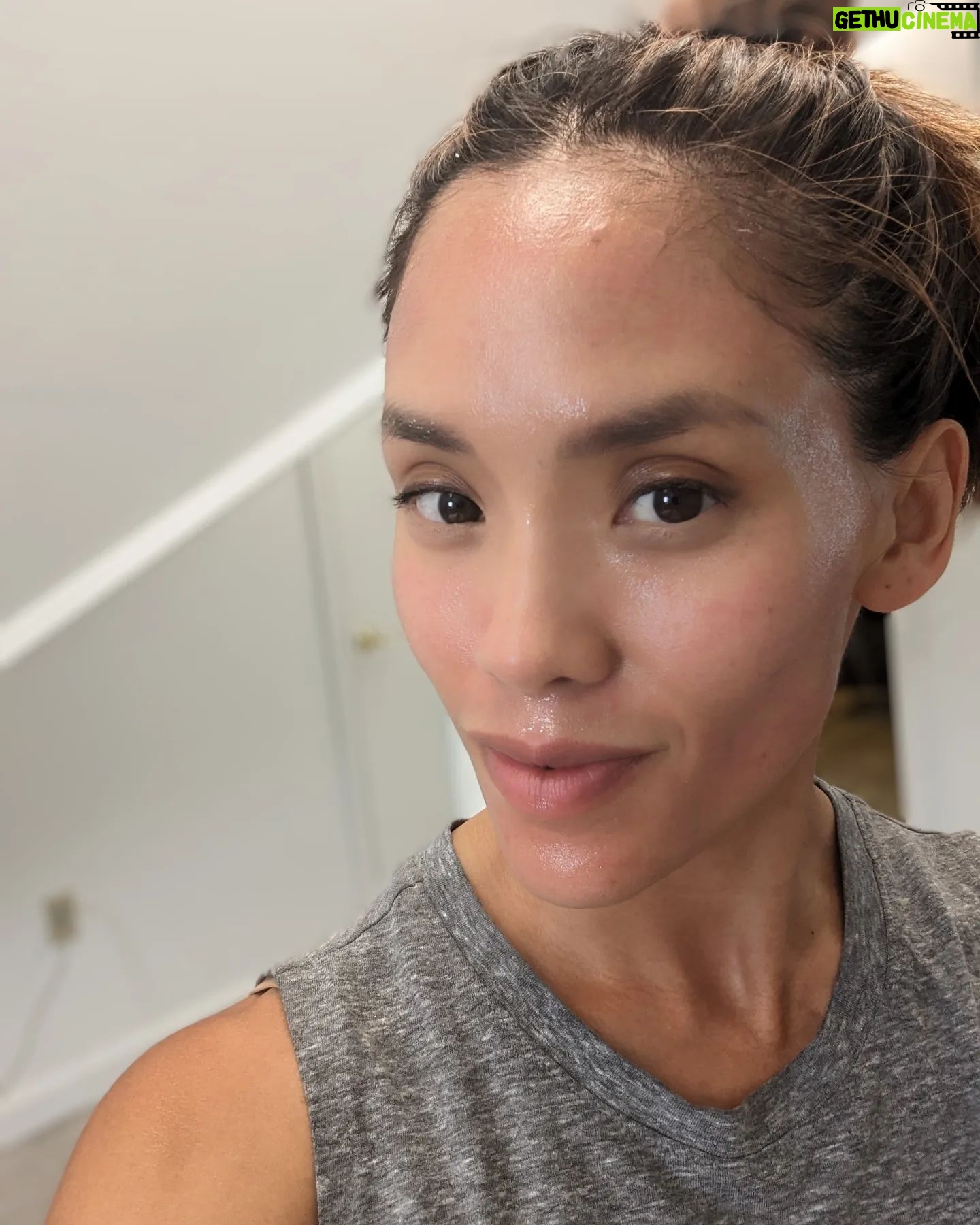 Jessalyn Wanlim - 3 Likes - No filters and going on 41! Thank you @toyosclinicaesthetics for round 2 of #mixtolaser resurfacing treatment. I've gotten so many compliments on my skin and now we're just working on some stubborn acne scars š¤
1. 15 minutes after treatment (and barely any redness at that!)
2. Waiting for numbing cream to do its work
3. Immediately after my mixto session
4. Dr. Melissa did my hands too since I have massive insecurities thereš
.
.
.
.
#antiaging #laserresurfacing #nashville #medspa #laserresurfacingtreatment #mixto