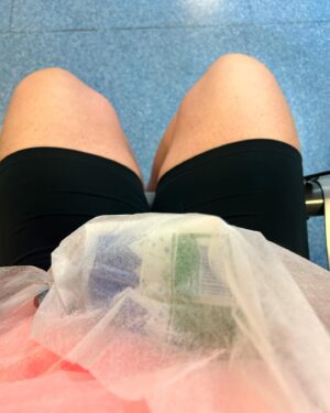Jessica Fostekew Instagram - ⚠️ this post contains a gross x-ray of my snapped arm bones 🩻 ⚠️

I won’t be posting any 🏋🏻‍♀️ for a while 😢 

On Sunday I broke the fuck out of my wrist and arm trying to learn a new gymnastic movement called a pull-over. KIDS: DON’T USE GRIPS FOR PULLOVERS PLZ. My body went over but my hands didn’t 🤮 

It was bad bad. I’m a twit for using grips for that movement but it was new and I just didn’t have a clue. Ugh. 

A man called Hugh at my gym is a guardian angel. He took me to hospital and stayed with me all day and evening then collected my car 🦸🏻‍♂️❤️

Big shout out to amazing @lg_nhs for taking incredible emergency care of me. On Tuesday I had surgery with a plate, pins AND a wire whacked in there 🦾

I’ve had so many kind kind things from friends I’m touched as absolute fuck 💐 

I’m 💔 to have lost an exciting acting job I had coming up (fairly, my character would have needed to have a broken arm for ten years 😂). But I’m already back to work in every other respect ✌🏻

Also left-only-handed lyf is ON. I’ve learnt left handed writing, injecting my own tummy with one hand and today I chopped up a BUTTERNUT SQUASH. I WILL NOT BE DEFEATED.

And my beloved PE. I’m gonna get such a fucking massive left arm and become the fastest bastard on a static 🚲 you’ve ever met. 

I’ll also have loads of therapy, naturally. 

Onwaaaaaaaaards (really fucking slowly)