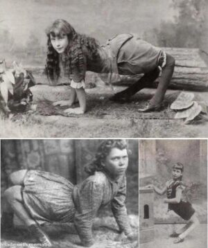 Jim Beaver Instagram - I learned something completely new and disorienting today. I saw a woman begging in the Gare de Lyon. She suffered from what I now have learned is genu recurvatum, a disorder in which one’s knees bend the wrong way. These old photos do not do justice to the distortion of this woman’s body. I’m quite surprised I got this old without ever hearing of this disorder.