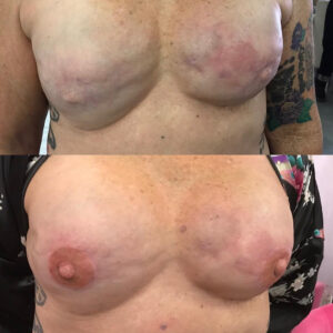 Joe Miñoso Instagram - I couldn’t possibly be any prouder or more excited to post about the tremendous journey my gorgeous wife has embarked on.  @areolarestorativetattoo provides nipple tattoos of the absolute highest quality to breast cancer warriors.  It paints a pathway for survivors to regain self confidence and reclaim their bodies.  This is an art form.  One that changes lives.  My beautiful wife Murphy has chosen this career path for the next chapter in her journey.  If you know her you know exactly how perfectly suited an artist she is for this beautiful, sensitive, & compassionate work.  I can’t wait to watch you blossom my love.  Follow her journey with me @murphyminoso #breastcancerwarrior #breastcancerawareness #breastcancersurvivors #areolarestorativetattoo #nipplesonfleek @davidallen