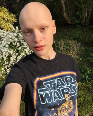 Joelle Instagram - Checking out an old Star Wars tee I haven't worn since last summer! 🌞🌸
.
.
.
#starwars #tshirt #joelle #london #spring #lipgloss #alopecia #no #coverup #c3po #r2d2 #girl #bald #flowers #blossom #garden #hazel #eyes