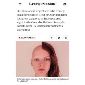 Joelle Instagram - I don't often voice my opinion on social media regarding other people, but after seeing the events that took place @theacademy on the weekend, I feel it is my duty as an alopecian and ambassador to say something. I feel compelled to say something that might be able to help society and the media industry understand and learn more about visual differences being celebrated in the right way, not pointing them out in the wrong way. My praise goes to @jadapinkettsmith for carrying herself with such grace in such a difficult situation in front of millions of people. 

This is even more important moving forward following the very sad news of the loss of 12-year-old Rio Allred who committed suicide due to bullying about her alopecia. My thoughts and deepest condolences are with Rio Allred's family and friends. I cannot imagine what they have endured. Please donate anything you may be able to spare to support them during this very difficult time. Please read Rio Allred’s story on the GoFundMe link here https://www.gofundme.com/f/rios-memorial-fund 

My thoughts about the events that took place at the Oscars have been published in the @evening.standard @esescapist they have been so kind as to add Rio Allred's GoFundMe page in the article linked here: https://www.standard.co.uk/escapist/alopecia-jada-pinkett-smith-disability-race-sexuality-joelle-b991075.html

To find out more information and support about alopecia, visit @alopeciauk 
.
.
.
#alopecia #alopeciaawareness #RioAllred #JadaPinkettSmith #Oscars2022 #Oscars #diversity #visualdifference #alopeciasupport #alopeciauk