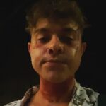 Jonas Ems