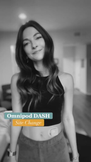 Kelsey Bascom Instagram - I’m so attached to my insulin pump. I mean, *literally*, I’m attached. 😅🤖
 
The idea of having an insulin pump used to be really scary for me, which is weird to think about, because now it feels completely natural to me, and I can’t imagine my life without my @Omnipod DASH. It took me 10 years before I even opened myself up to the idea of wearing a pump, and when I heard that a tubeless one existed, I had to at least try it. I realized that change doesn’t have to be so scary, and if for some reason, I didn’t like it, I could always go back, but as you can see, I didn’t. 💙
 
For more info on Omnipod, check out the link in my bio or go to http://Omnipod.com/Kelsey
 
#Sponsoredpodvocate #Omnipod #Podder #OmnipodDASH #insulinpump #t1dlookslikeme #t1d #t1dwarrior #type1diabetes