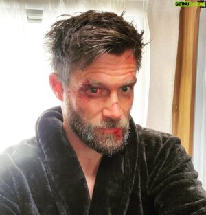 Ken Duken Instagram - #aboutthisyear lots of #fakewounds and #realbruises something #crazy #coming #nextyear @skydeutschland #skyseries #behindthescenes #makeup by @georgkfx @ameliehartwig #illkeepyouposted 🤙🔥❤️