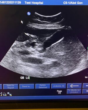 Keonna Green Instagram - Scrub Life 🫀

Third slide: It’s not a baby. It’s my upcoming profession.
Who knew scanning the gallbladder would be so much fun!

Halfway through the program and I couldn’t be more excited to share to my experiences as an upcoming Medical Sonographer.