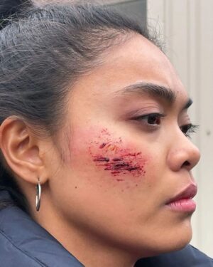 Kim Adis Instagram - THANK YOUUUU FOR WATCHING YW KILLER'S SHADOW!!
Here's some cheeky BTS 😋
Makeup and Hair Treatment for Katja by the lovely and amazing Renata Gilbert & @linagerdus 💛✨
@youngwallander_ @yellowbirdfilmochtv @netflix @netflixnordic #youngwallander