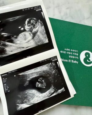 Kim Min-jung Instagram - .
안녕하세요. 방송인 김민정, 조충현입니다.
저희 가족에게 새 생명이 찾아왔어요❤️
제 배 속에 또 다른 심장이 콩콩 뛰고 있답니다.
여러분~ 아인이 동생이 생겼어요~!!

결혼하고 가족 계획 질문을 받으면 
늘 "둘 이상 셋은 낳고 싶어요. 
딸 낳을 때까지 낳을 거예요." 라고 답하곤 했는데
첫 아이 낳아보니 아주 호기로운 생각이었구나 싶었어요.
내 맘대로 안 되고 굳은 의지로도 쉽지 않더라고요~
내가 나 자신을 과대평가 했구나 하는 생각도 들었어요.

힘들지만 그래도 감사와 행복이 큰 나날을 보내며
내가, 우리 부부가, 우리 가족이 
더 깊어지고 단단해짐을 느끼며 둘째를 기다렸는데요.
막상 둘째가 찾아오니 반갑고 기쁘기도, 두렵기도 했지만
잘 할거라는 믿음을 갖고 두려움은 넣어두었습니다ㅋㅋㅋ

둘째 태명은 콩콩이예요~
아인이가 콩을 무척 좋아하고 콩콩콩체조도 좋아해서
콩콩 콩콩 하다가 콩콩이로 지었어요ㅎㅎㅎ

소중한 생명 잘 품으며 첫째도 잘 보살피며 
올 여름 함께 만날 날을 기대하고 있어요.
올해 또 새로운 경험을 하게 될 저희 응원해주실거죠?
늘 오늘보다 나은 내일을 위해 노력하겠습니다!
올 한 해 청룡의 기운 받아 
여러분 건강하시고 행복한 일 가득하시길 바랍니다. 
고맙습니다 :)