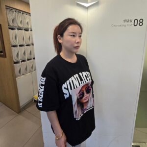 Lee Chae-dam Instagram - #덕소리 474-5 희빌딩 5층 #덕소엔비의원 #보턱스 #피코토닉
#재생레이져 
 
덕소 엔비의원에서 이마, 미간, 눈가, 턱, 입술, 팔자, 보턱스 맞고, 기미 피코토닉하고, 재생하는 레이져까지 하고 왔어요^^ 추지선 원장님 너무 너무 친절하시고 리터치도 꼼꼼히 잘 해주셨어요😍 효과도 바로 바로 나타나고 굿굿굿...
이상은 실장님 친절하고 상담 잘해주셔서 감사합니다 ^^👍