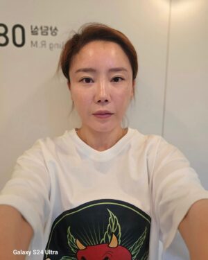 Lee Chae-dam Instagram - " 덕소엔비의원 " 에서 3차!!!!! 피코토닉하고 기미,잡티,흉터 실펌x를 3차 하고 왔어요 한달만에~ 너무너무 깨끗해졌쥬~^^