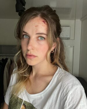 Leonie Brill Instagram - Wat soll ich sagen… Rough day at work 🤷🏼‍♀️
Make-up by amazing @juliaclotten ❤️
_______________________
#newproject #roughday #makeup #movie #specialeffectsmakeup #actress #shooting #work #news #acting #newmovie #cologne #besteleben