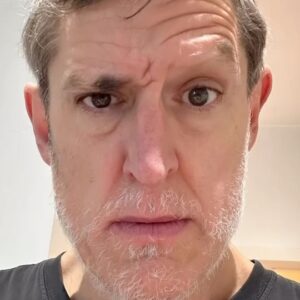Louis Theroux Instagram - I’d like to know how I’m supposed to continue a career based largely on raising and lowering different eyebrows WITHOUT ANY EYEBROWS!! #alopecia I’m seriously thinking of getting them tattooed back on but it feels like a big step! Thoughts?