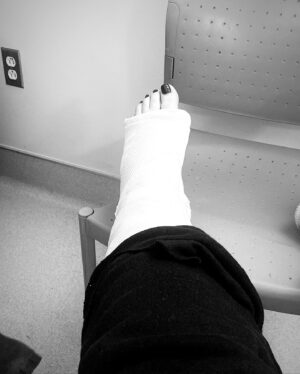 Lucy Loone Instagram - sooo i was just walkin to the store to get some blunt wraps yesterday and i broke my MF FOOOOOT BONE😭  this really shook me all the way up 😂☹️i’m not gonna lie i have not been treating my body the best that i can lately and i’ve felt my spirit telling me to get it together and take care of myself for a long time:( even though i’m in so much pain right now i honestly think this needed to happen to me because i really want to be the best version of myself i can possibly be. i’m so so passionate about my art and the ways that it can possibly help and heal and thats not going to happen if i don’t heal my fucking self. i wanna be transparent with y’all because y’all have shown me so much love and support throughout my journey as an artist and i want nothing more than to deliver my best work and energy so that we can have fun and thrive and maybe even make a difference in this god forsaken world🥺❤️ so for the next 6 weeks or however long it takes my foot to heal ima be doing some inner and outer healing, writing songs,making press on nails and cultivating the next chapter in the looneyverse 💗🥲 i love y’all so much 💋🥺thank y’all for riding with me and thank you @zepkins @ravenvalentinee @tylerlazzari for being real asf and helping me through yesterdays traumatic ass day 🤣🥺🥺🥺💖 we can never take our lives for granted please take care of yourselves