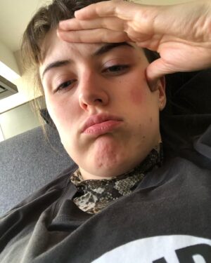 Lucy Moss Instagram - oh hey fever

*TO CLARIFY I HAVE HAYFEVER NOT COVID THANK U FOR THE CONCERN EVERYONE LOVE U ALL OOPS*