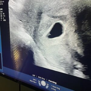 Luis Peña Instagram - Well it’s official @morganskyebates and I are gonna be parents! If it’s a boy we’re naming him after my little brother @benlv2 and my favorite fighter @nigelbennofficial Benjamin Nigel Peña and if it’s a girl after my moms Honora Rosalia Peña we’ll see you 3/26/24
