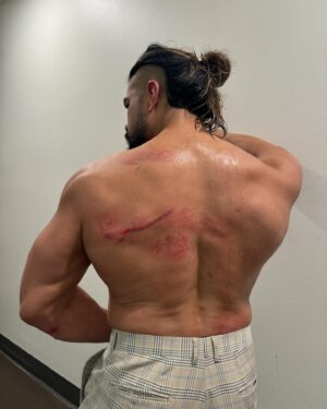 Manuel Alfonso Andrade Oropeza Instagram - Smile at the pain!!