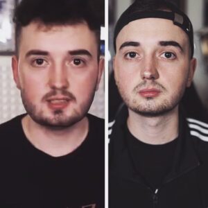 Marcel Althaus Instagram - Links seht ihr ein Bild von mir aus dem März 2019, rechts eins von heute. Ich habe gerade ein YouTube-Video zu meiner kleinen Transformation bisher hochgeladen. (Bin aber noch nicht am Ziel.) Ich will hier nicht behaupten, dass ich ein geiler Typ sei oder voll den Plan vom Abnehmen hab. Ganz sicher nicht.. Trotzdem bin ich stolz auf meinen Weg und werde ihn weitergehen, weil ich endlich Spaß daran gefunden habe, etwas für mich zu tun. Ihr habt vielleicht auch gemerkt, dass ich nicht ein einziges Mal gepostet habe, wenn ich im Gym war/bin. Wollte damit zumindest solange warten, bis ich einige Erfolge zeigen kann. Aber auf den ganzen Kram bin ich im Video deutlich detaillierter eingegangen. Zieht es euch gerne rein, würde mir viel bedeuten ❤️