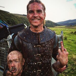 Marco Ilsø Instagram - Fooling around with the prosthetics 😁 👨🏼🖕🏻