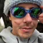 Mark McMorris