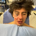 Mark McMorris