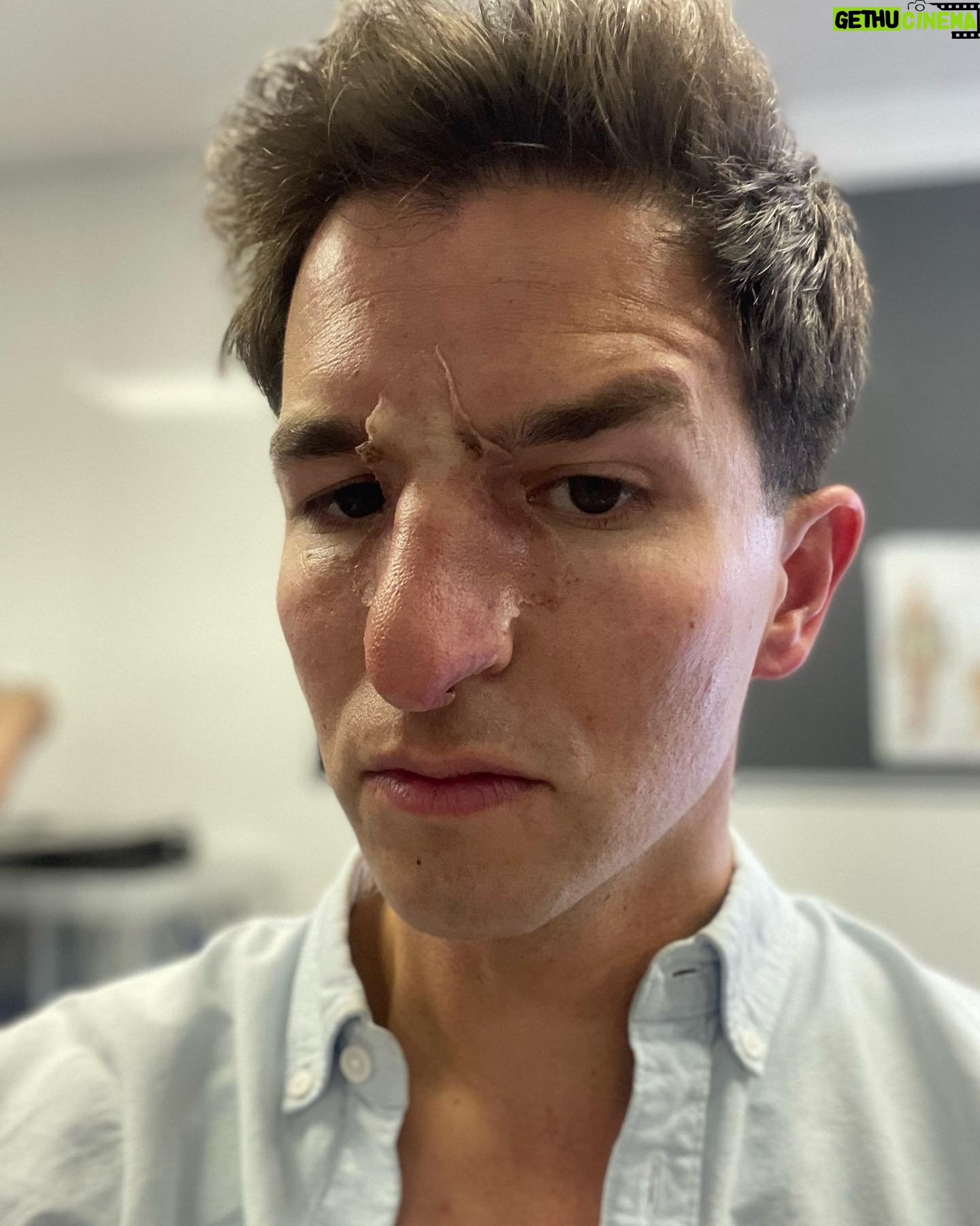 Matteo Simoni - 10.7K Likes - Lodeās avonturen š
-Lode met bril en āsmosā-snor.
-Lode met neus van De vinger.
-Lode met vlees aan oor.
-Lode met zijn vriend Wil in de regen.
-Lode met knielappen en helm.
-Lode waant zich een Beatle.
-Lode op de set van The sound of Music.
-Lode met fake-kind in Polen.
-Lodeās kapsel op de foto met Kevin de Bruyne.
-Lode NU IN DE CINEMA met zijn zus en beste vriend!
@wil_defilm š¹