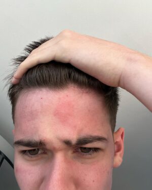 Max Mills Instagram - Not a very chronological dump but just posting to let you know, we’re still alive, we’re working on a lot of crazy stuff, and we can’t wait to show you guys in future. Just bear with us, as we wanna make sure it’s all perfect. Love you all ❤️ (also got stung in the face by a wasp if you wanna see it’s in the last slide)