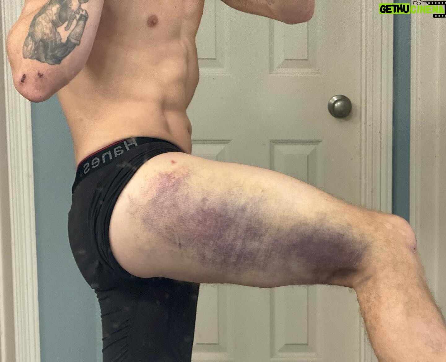 Michael Jones - 10.8K Likes - Before my Onewheel was delivered, I borrowed @gavinfree’s to practice and I ate shit downhill. Turns out, I’ve been beaten and bruised over much dumber shit so one little spill wasn’t going to stop me from riding BB SK8. 100 miles later, we’re getting pretty good!