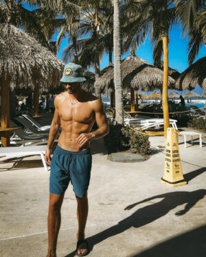 Michel Duval Instagram - Me picó una aguamala 🪼