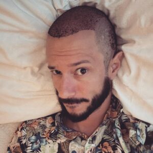 Michele Poggi Instagram - Terzo giorno di degenza (quindi sì ancora insanguinato e anti-TOS di Twitch), con più antidolorifici in corpo che acqua e un percorso di “Perfezionamento del Maiku” non da sottovalutare dinanzi.

…E non solo a livello fisico, ANZI. Non ho decisamente “scelto” il mio motto a caso. 🎯

CHE_PALLE però esser bloccato a letto per giorni fra spruzzini, pillole e pomate!
