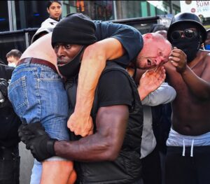 Michelle Dewberry Instagram - “It’s not black versus white, it is everyone versus the racists.” Full respect to you #PatrickHutchinson .
.
http://news.sky.com/story/blm-supporter-who-helped-injured-protester-if-we-hadnt-intervened-i-think-he-may-have-died-12006819
