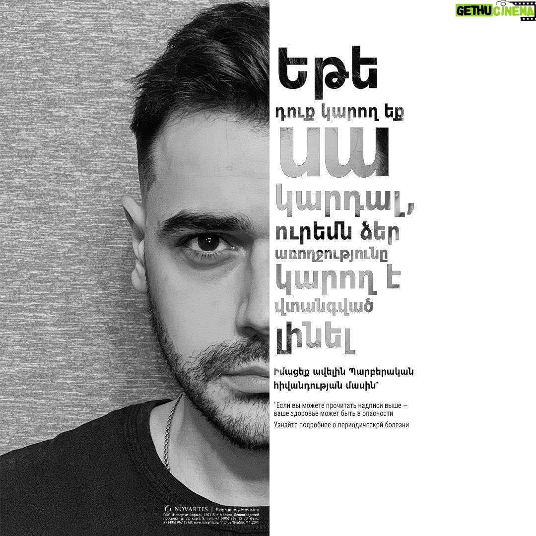 Mikael Aramyan - 2.8K Likes - Друзья!
Сегодня, вместо подведений итогов года, поздравлений со всеми праздниками и красочных фотографий с ёлкой, я хочу поделиться с вами очень важной информацией. Пожалуйста, ознакомьтесь с ней и поделитесь с теми, кого это может коснуться.
Речь идёт о сравнительно редком, генетически обусловленном наследственном заболевании, встречающемся среди народов стран Средиземноморья, чаще всего у армян, евреев, арабов и очень редко у лиц других национальностей.
Его называют средиземноморской лихорадкой, периодической болезнью, иногда, в народе, «армянской болезнью».
Основная сложность в диагностировании заболевания заключается в том, что оно не имеет специфических симптомов. Но частое повышение температуры, боль в животе, грудной клетке или суставах может косвенно указывать именно на это заболевание.
Средиземноморская лихорадка – серьёзное заболевание. Не все знают, что в запущенных случаях и при неправильном лечении периодическая болезнь может приводить к осложнениям (к амилоидозу и потере почек), а затем и к смерти.
Также важно знать, что практически у всех пациентов можно добиться стойкого улучшения и даже ремиссии заболевания, если принимать правильные препараты и следить за признаками воспаления.
Об этой болезни говорят мало, зато очень много домыслов.
Где правда, а где вымысел - можно узнать из спецпроекта «Периодическая болезнь: вовремя обнаружить и правильно лечить» агентства «Новости-Армения». В рамках проекта будут представлены: экспертная информация о заболевании, интервью с врачами, пациентами, опрос общественного мнения на эту тему.
Прошу вас, будьте внимательны! Прислушивайтесь к своему организму и, в случае проблем, обращайтесь только за квалифицированной помощью! #FMF #периодическаяболезнь #ССЛ