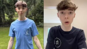 Nuno Markl Instagram - Para quem está neste momento a ouvir o Homem Que Mordeu o Cão: que idade tem este jovem?