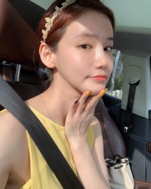 Oh In-hye Instagram - 화상.턱가리기..조심좀하자. 좀. 덜렁이.