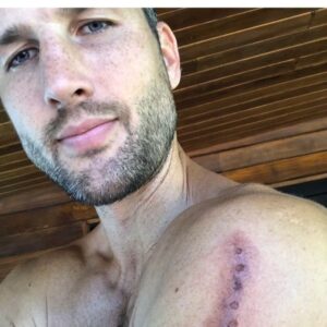 Parker Young Instagram - No poisonous tree frogs were harmed in the poisoning of this strange man. There’s a reason this little frog has no know predators. Namaste away from him from now on... 🐸 🙏🏼❤️ kambo has been used for thousands of years by indigenous tribes in the Amazon jungle. It was used to cleanse and strengthen the mind, body, and spirit of hunters before a hunt...please please please don’t try this at home