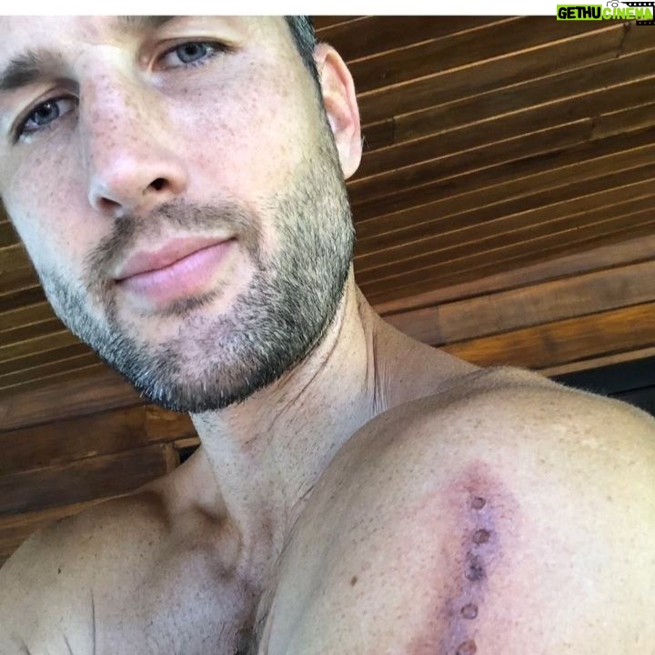 Parker Young - 6.9K Likes - No poisonous tree frogs were harmed in the poisoning of this strange man. There’s a reason this little frog has no know predators. Namaste away from him from now on... 🐸 🙏🏼❤️ kambo has been used for thousands of years by indigenous tribes in the Amazon jungle. It was used to cleanse and strengthen the mind, body, and spirit of hunters before a hunt...please please please don’t try this at home