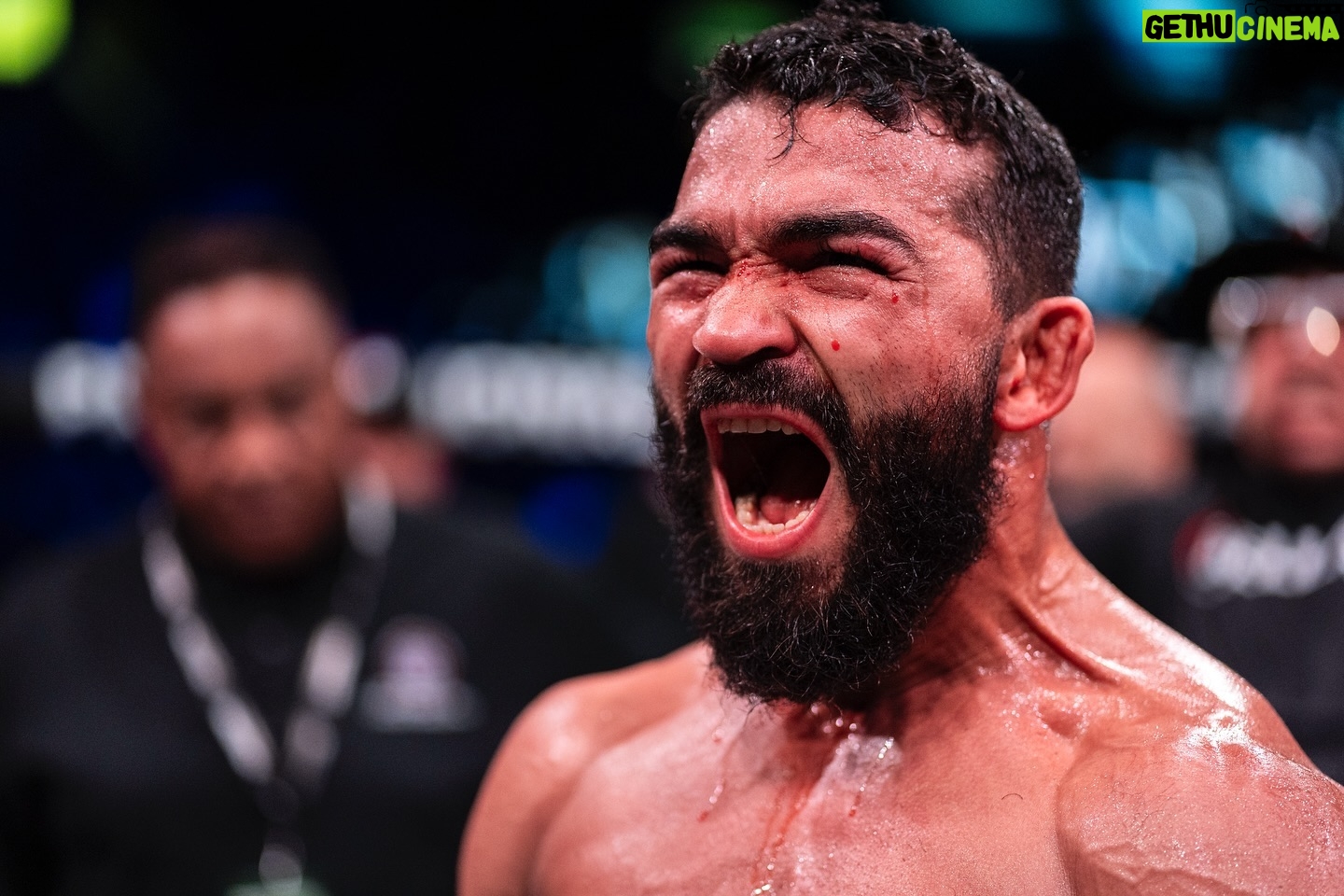 Patricio Freire - 2.7K Likes - Before I came into this fight, I had doubts about how my post surgery performance would be. Then he landed that punch and the beast awakened. Iām back.
Antes de fazer essa luta, eu tinha dúvidas sobre como seria minha performance após a cirurgia. Aà ele acertou aquele soco e o monstro acordou. Estou de volta.