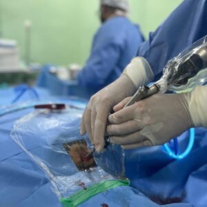 Patricio Freire Instagram - No domingo passei por uma delicada cirurgia na cervical para tentar voltar a lutar normalmente. Haviam vários riscos envolvidos, motivo pelo qual vinha optando por um tratamento conservador. Mas isso contribuiu diretamente para minhas duas derrotas recentes e o primeiro - e espero que último - nocaute sofrido na minha carreira. Felizmente, graças a Deus e ao dr. Marco Moscatelli e sua equipe médica, a cirurgia foi um sucesso, poderei lutar novamente e estou me sentindo ótimo. Em 6 meses estarei de volta e em plenas condições.

On Sunday I went through a delicate surgery on my neck to try to return to fighting normally. There were several risks involved, reason why I had opted for a conventional treatment first. But this contributed directly to my two recent losses and the first - and I hope the last - knock out suffered in my career. Happily, thanks to God, dr. Marco Moscatelli and his medical team, the surgery was a success. I'll be able to fight again and I'm feeling great. In 6 months I'll be back in perfect condition.