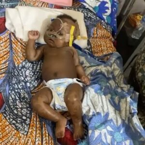 Prince Thompson Iyamu Instagram - 🛎️ ATTENTION 🛎️ ATTENTION 🛎️ ATTENTION 

Miracle Ogbeide, a 5-month-old baby girl, faces a daunting battle against kidney disease at the Teaching Hospital (UBTH) in Benin City, Nigeria. 

This innocent soul needs urgent medical attention to survive, but the burden of hospital bills weighs heavily on her family. 

Your compassionate donation can be a lifeline for Miracle and her family. 

To contribute, please send your support to the account details provided below: 

Account Name: JENNIFER OGBEIDE, 
Account Number: 3121937325, 
Bank: FIRST BANK. 

For further details or inquiries, please don’t hesitate to reach out to @jenny_berry_02_ on  234 808 924 1007

Your generosity and kindness can make a profound difference in little Miracle’s fight for life.