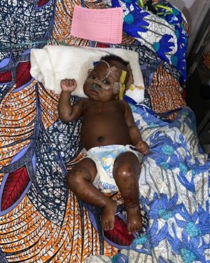 Prince Thompson Iyamu Instagram - 🛎️ ATTENTION 🛎️ ATTENTION 🛎️ ATTENTION 

Miracle Ogbeide, a 5-month-old baby girl, faces a daunting battle against kidney disease at the Teaching Hospital (UBTH) in Benin City, Nigeria. 

This innocent soul needs urgent medical attention to survive, but the burden of hospital bills weighs heavily on her family. 

Your compassionate donation can be a lifeline for Miracle and her family. 

To contribute, please send your support to the account details provided below: 

Account Name: JENNIFER OGBEIDE, 
Account Number: 3121937325, 
Bank: FIRST BANK. 

For further details or inquiries, please don’t hesitate to reach out to @jenny_berry_02_ on  234 808 924 1007

Your generosity and kindness can make a profound difference in little Miracle’s fight for life.