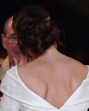 Princess Eugenie Instagram - Today is International Scoliosis Awareness Day. I just wanted to share my scar and encourage anyone out there who’s gone through something similar to share theirs with me. 

Let’s be proud of our scars! I’d love to repost any of your images on my stories so please tag me and I will share. 

To all of you who have just received the diagnosis, to those wearing braces, to those recovering from an operation and for those who have lived with a scar for years - My thoughts are with you on Scoliosis Awareness Day. Thank you to the doctors, nurses, physiotherapists and researchers at @scoliosis_sr 

#internationalscoliosisawarenessday