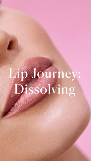 Rachel Brann Instagram - PART 2 of my #lipjourney I have finished my first round of dissolving and this is my second session with @jordonio.np 💋 I’ll be making a few more videos that go over the cost of everything I got done and some lip tricks and of course the very requested spoof videos of my bigs lips. #lipfiller #lipfillerbeforeandafter #transformation
